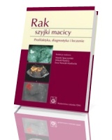 Rak szyjki macicy